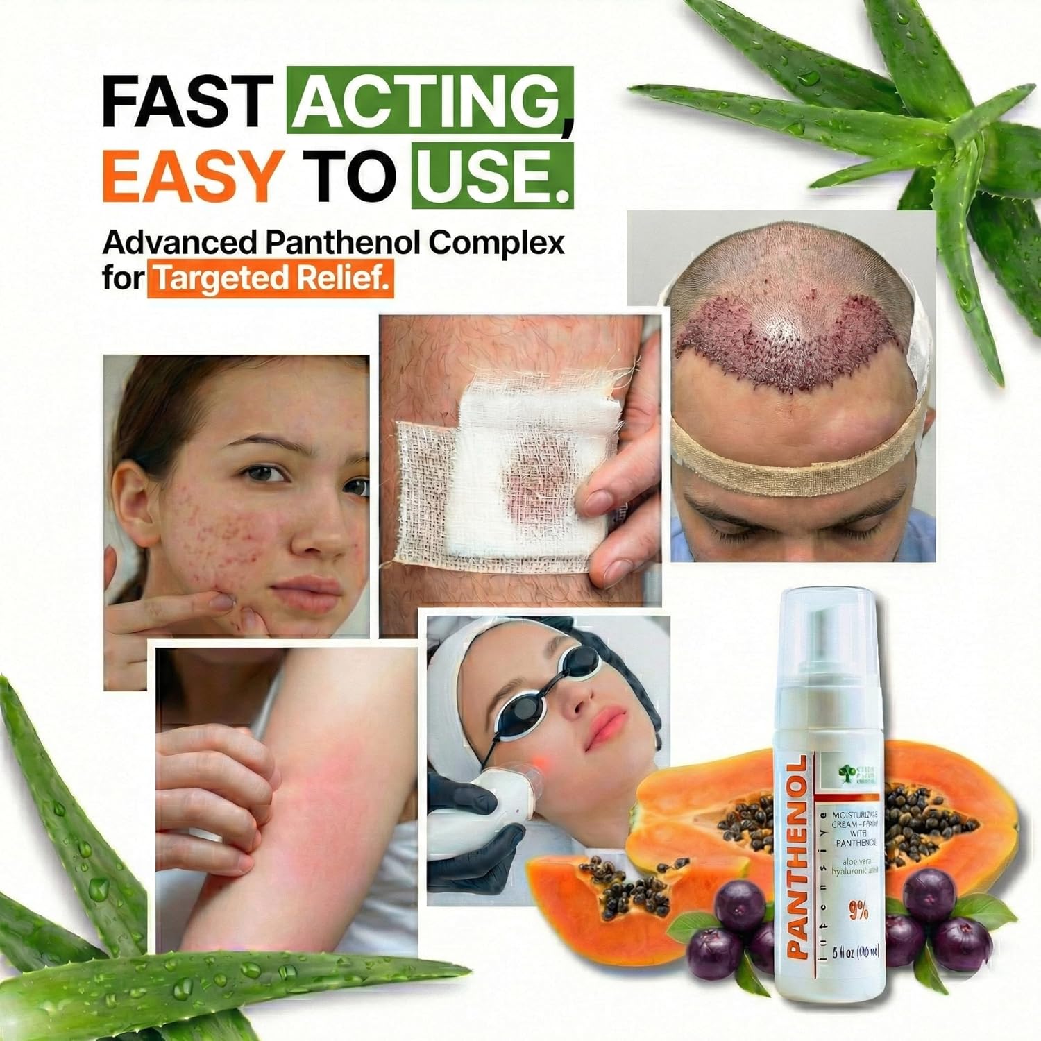 9% Panthenol Foam After Sun & Instant Redness Relief| Barrier Repair with Aloe & Hyaluronic Acid| Post Acne, Procedures, After Tattoo Care & Hair Transplant Spray | Baby & Sensitive Skin Safe